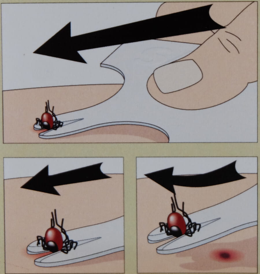 Karta do bezpiecznego usuwania kleszczy KleszczKarta - obrazek 7